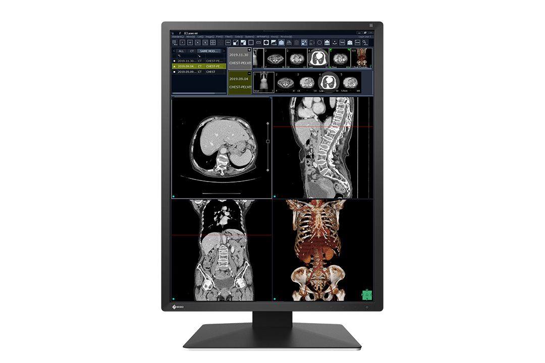 RadiForce RX270 | 2-MP color monitor for radiological reporting